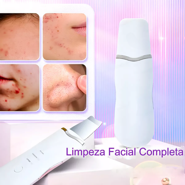 Peeling Ultrassônico E Ionização Portátil/ Anti Cravo E Acne - Image 5