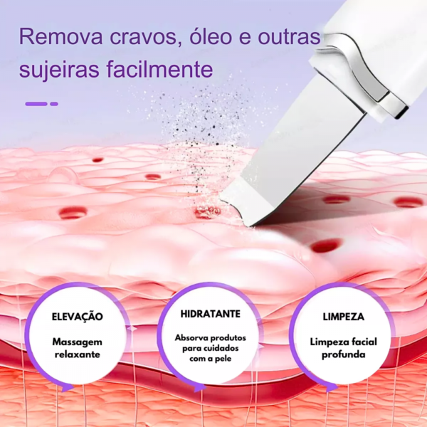 Peeling Ultrassônico E Ionização Portátil/ Anti Cravo E Acne - Image 4